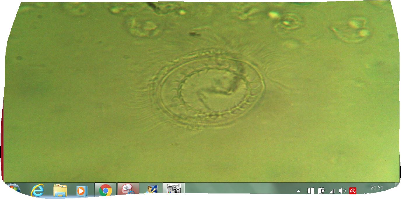 vorticella?